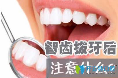 拔了智齒后要注意什么事項(xiàng)？深圳麥牙口腔的鄭蒼尚來解答