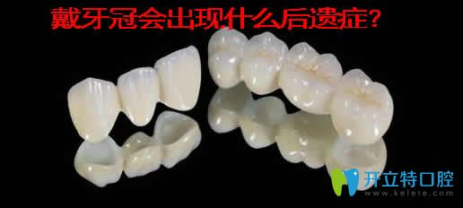 戴牙冠會出現(xiàn)什么后遺癥？介紹牙冠的種類及價格