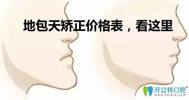 公布地包天矯正價格表 關于反頜/地包天戴牙套多少錢看這里