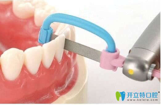 請(qǐng)看：正畸中鄰面去釉對(duì)牙齒有危害嗎？