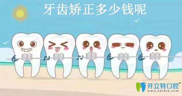 聽(tīng)說(shuō)深圳港龍醫(yī)院口腔科固定矯正和隱形矯正價(jià)格很親民哦!