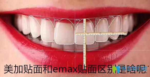 瓷貼面品牌千千萬，帶你了解美加貼面和emax貼面區(qū)別是啥