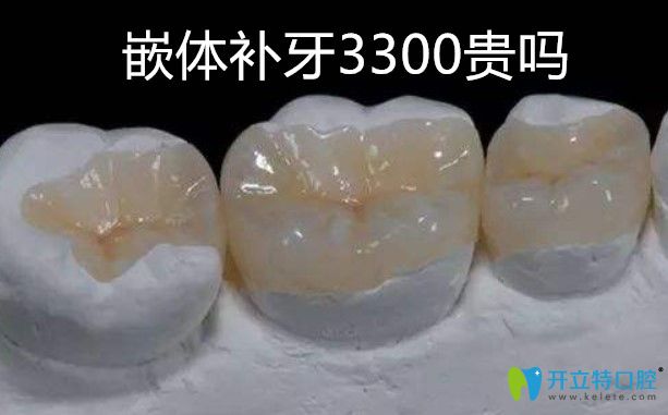 補(bǔ)牙！補(bǔ)牙！關(guān)于嵌體補(bǔ)牙3300貴不貴專業(yè)機(jī)構(gòu)給出了答案