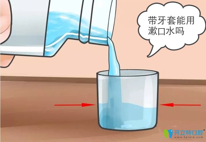 正畸帶了鋼牙套是不是要用漱口水？小姐姐們趕緊get起來吧