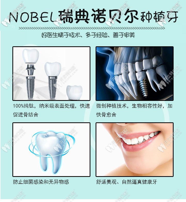 瑞典諾貝爾種植體優(yōu)勢