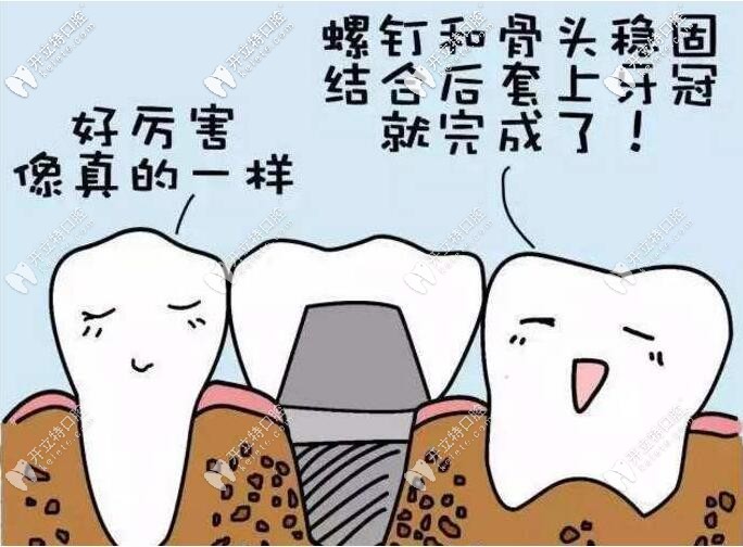 種植牙能和真牙一樣嗎 種植牙能和真牙一樣嗎