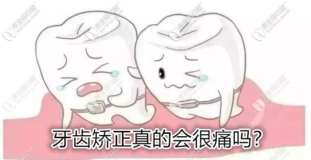 你知道矯正牙齒的痛算幾級疼痛嗎?來看看整牙哪步較疼吧！