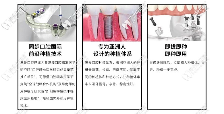 即拔即種種植牙技術(shù)