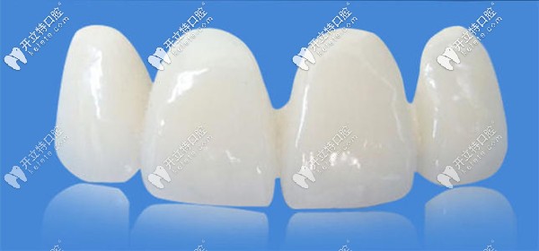 國產(chǎn)美晶瓷PK愛爾創(chuàng)全瓷牙哪個好？來看價格及優(yōu)缺點~