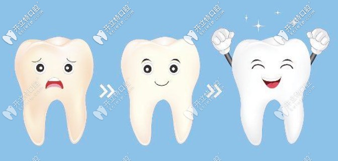 美白牙齒的方法有哪些？這有美牙五大方法效果及優(yōu)勢對比