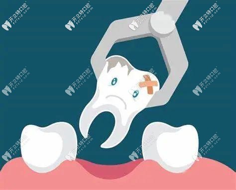 誰知道在鄭州唯美口腔拔智齒要多少錢?是否可以刷醫(yī)?？? border=